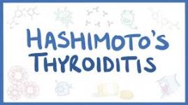 Hashimoto da antienflamatuar tedavi (LAZER TEDAVİSİ)