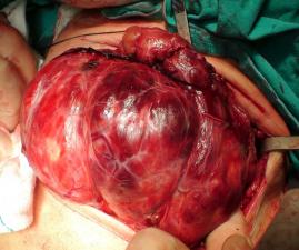 Kitle çıkarılmak üzere